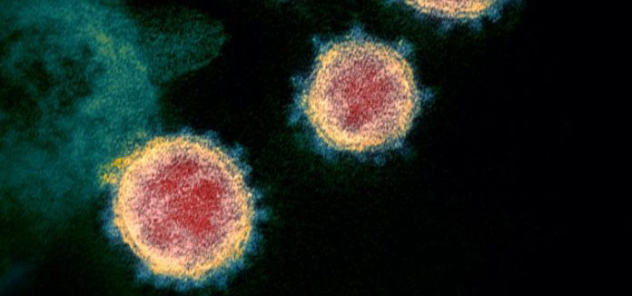 Cellule infette da SARS COV-2